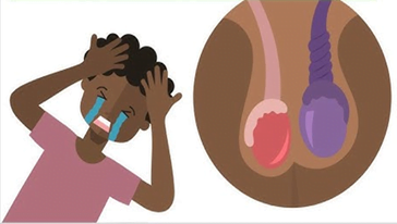 XOẮN TINH HOÀN LÀ GÌ?